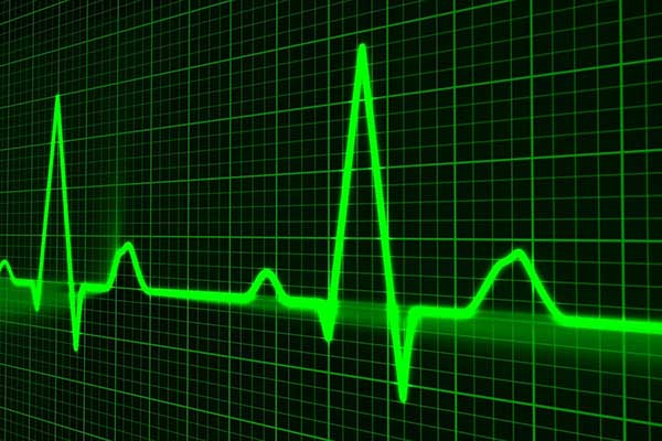 Monitoring health vital signs via smartphone - learn more in the Prospector Knowledge Center.