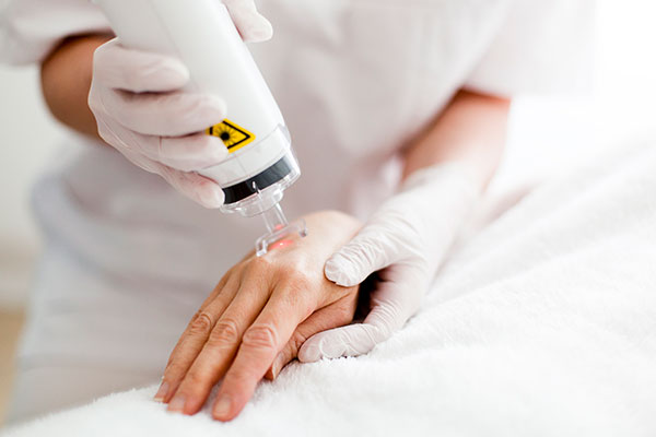 Laser skin resurfacing